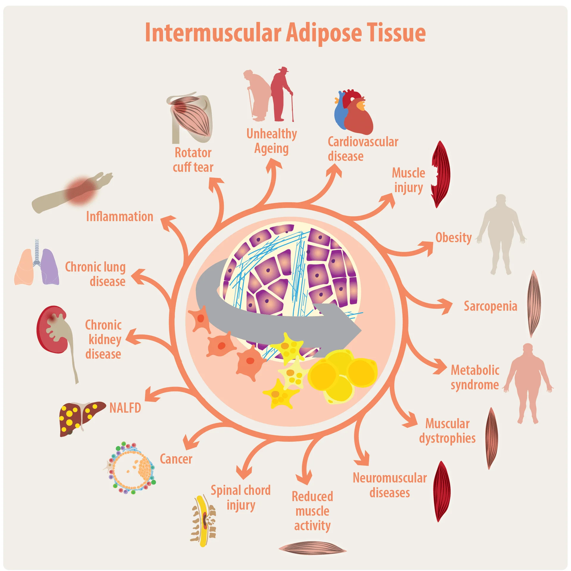 Figura científica Intermuscular Adipose Tissue
